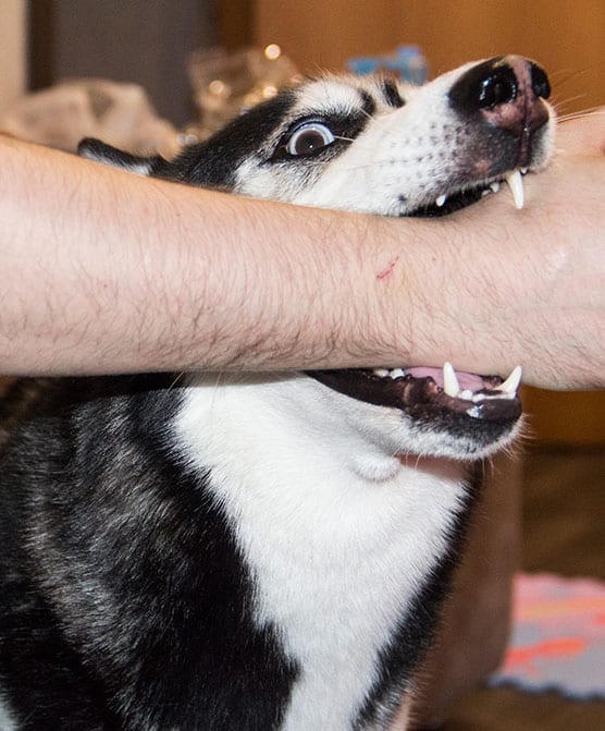 Fotografía de un perro mordiendo la muñeca de una persona en un incidente de mordedura de perro.