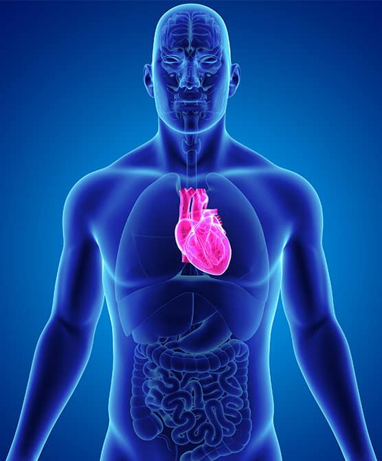 What to know before you file a IVC filter lawsuit.