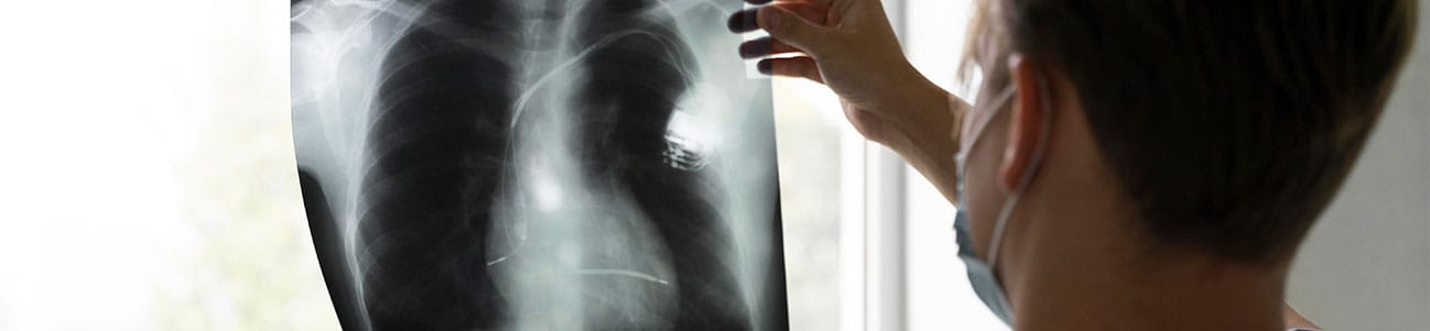 Oklahoma mesothelioma lawsuits.