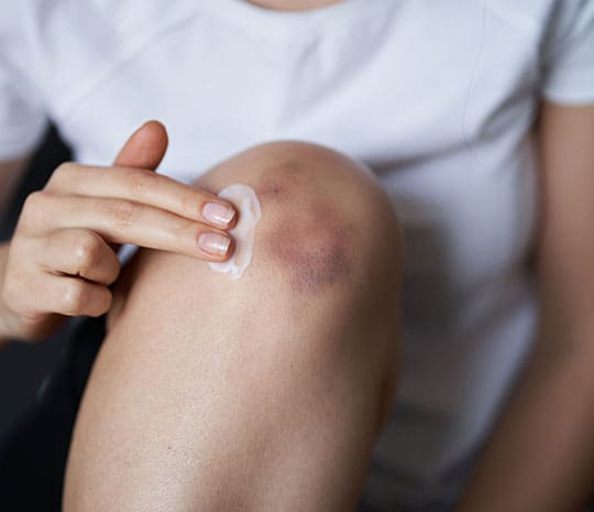 Typical slip-and-fall injuries.